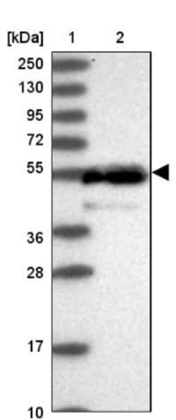 CLPB Antibody, Novus Biologicals:Antibodies:Primary Antibodies